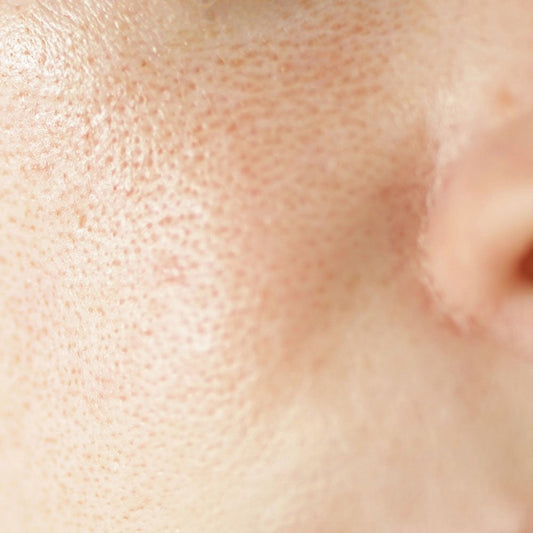 Open Pores