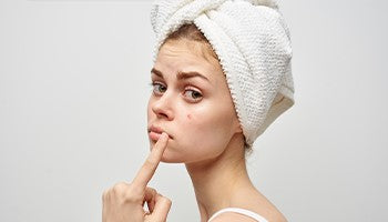 Pimples