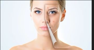 Best Foods for Acne-Prone Skin | Natural Remedies That Work