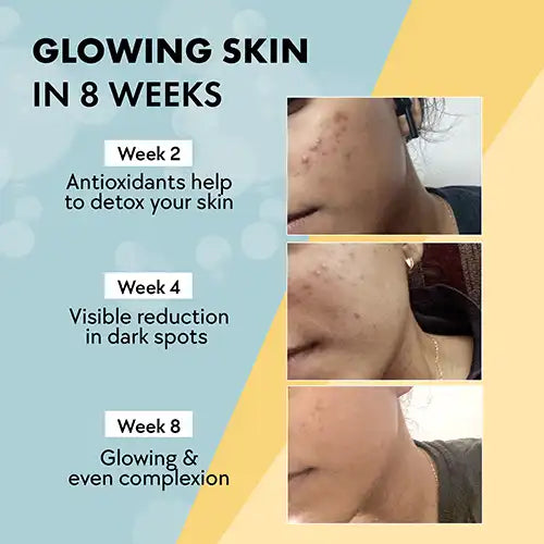 Chicnutrix Glow Glutathione Tablets – 8-Week Skin Glow Challenge with Visible Pigmentation Reduction