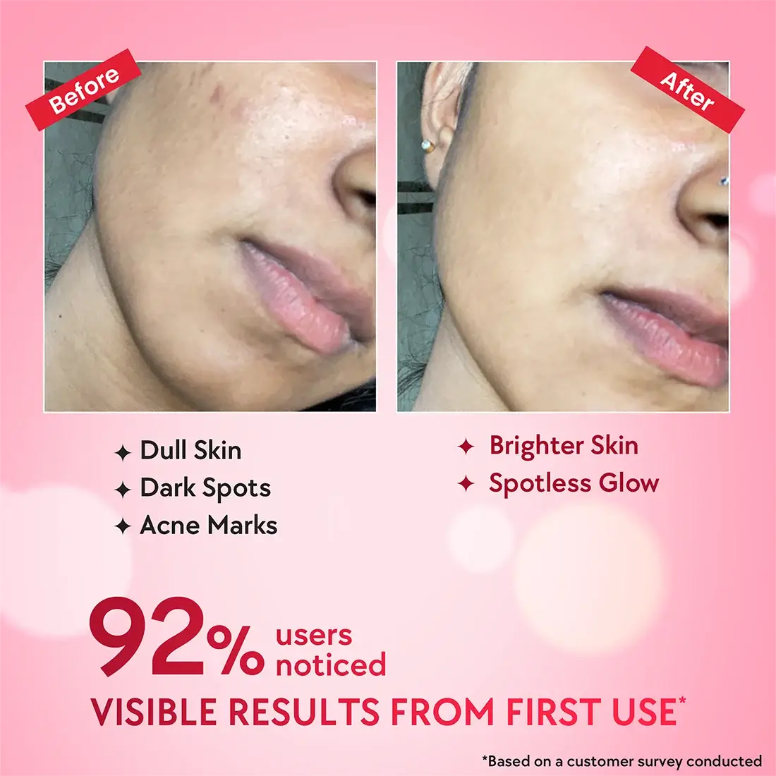 Outshine Korean Face Serum