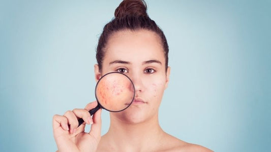 The Gut-Skin Connection: Why IV Drips Can’t Fix Acne, Pigmentation, and Dullness