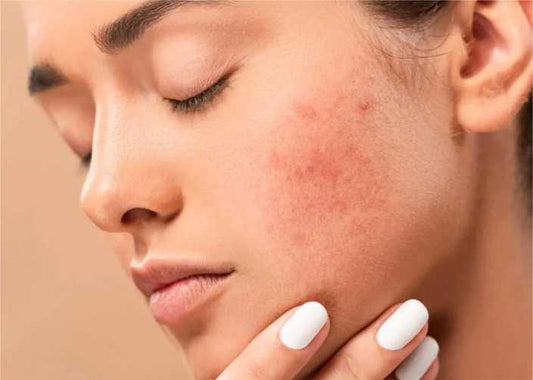 Vitamin c for Dark Spots
