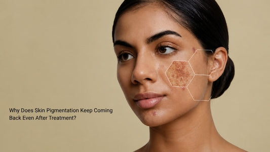 Why Does Skin Pigmentation Keep Coming Back Even After Treatment?