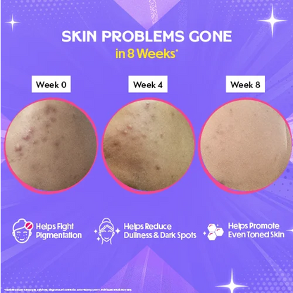 Glow – Glutathione Tablets for Skin Glow & Even-Toned Skin - Blackcurrent