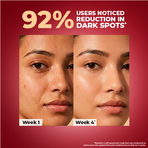 Chicnutrix Outshine Face Serum for Pigmentation, Dark Spots & Glow Chicnutrix Outshine Face Serum for Pigmentation, Dark Spots & Glow