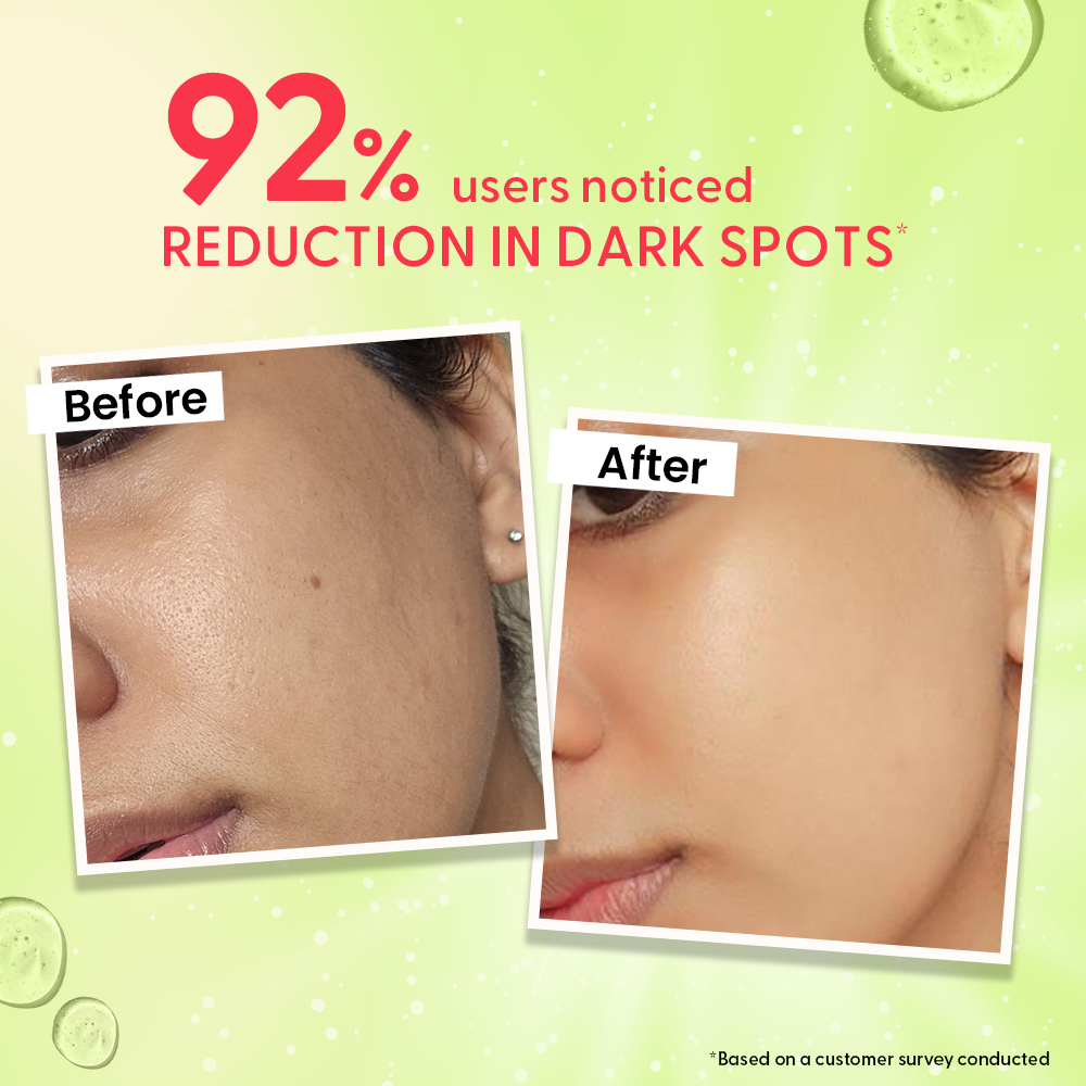 Outshine Korean Face Serum – Fades Dark Spots & Brightens Skin with Glutathione, Niacinamide & Vitamin C