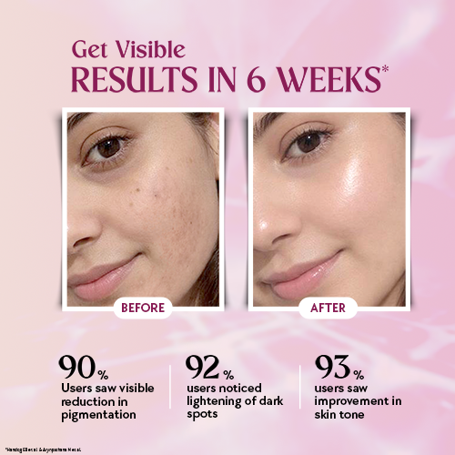 Glow Advanced Liposomal Glutathione Tablets for Pigmentation Chicnutrix Glow Advanced Liposomal Glutathione Tablets for Pigmentation Chicnutrix