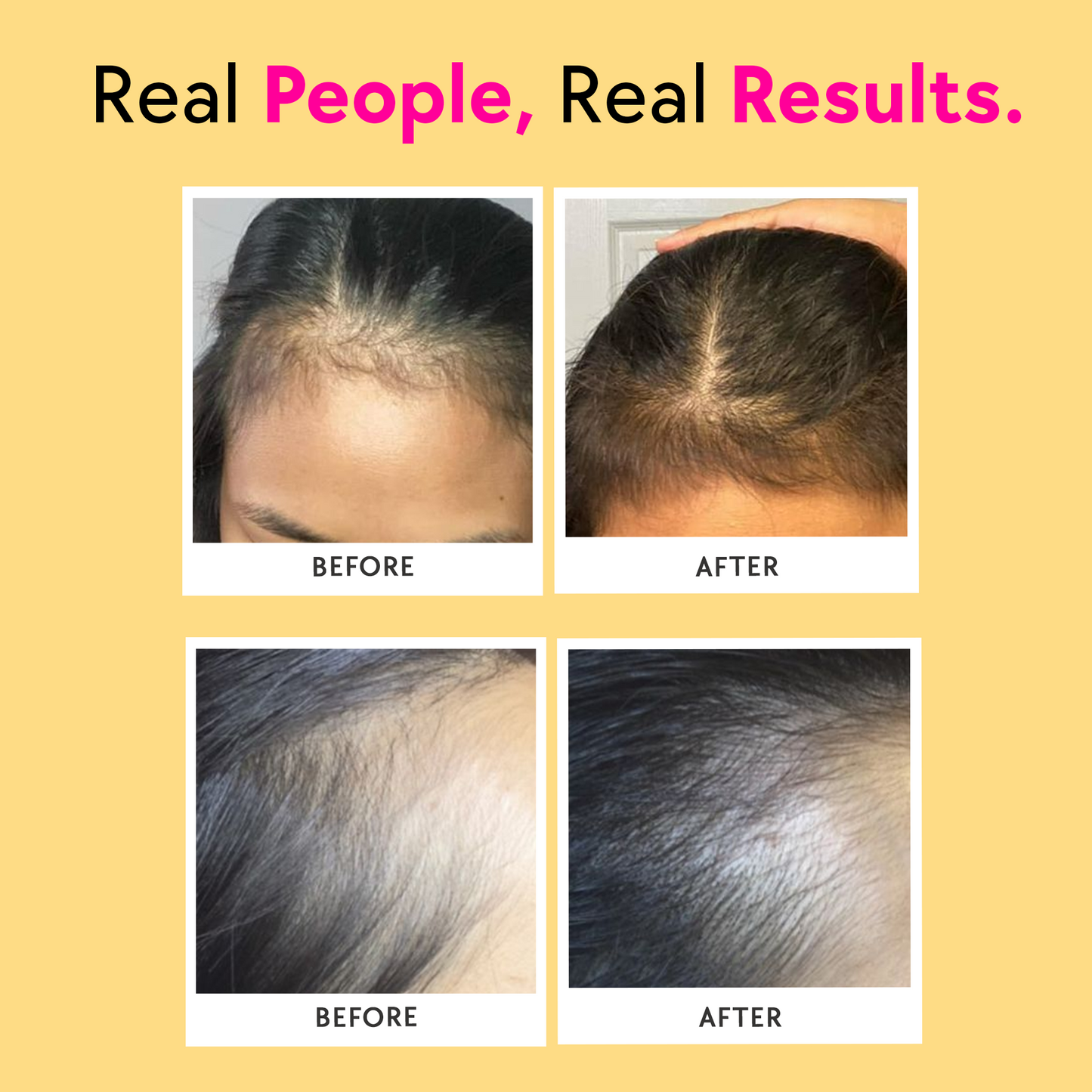 Bounce – Keratin Boosters & Biotin for Hair Growth & Hair Fall Control - Mango