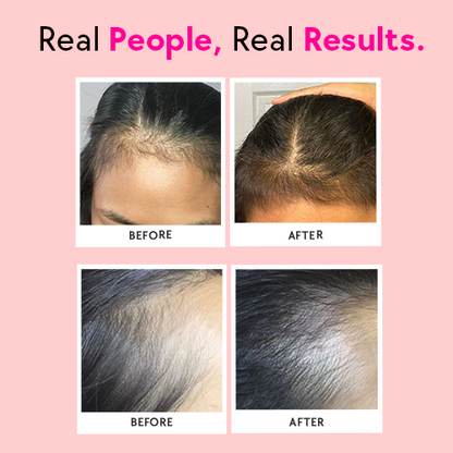 Bounce – Keratin Boosters & Biotin for Hair Growth & Hair Fall Control - Raspberry