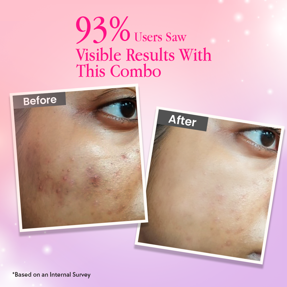 glutathione before and after face Glutathione Tablets + Face Serum Combo for Glowing Skin
