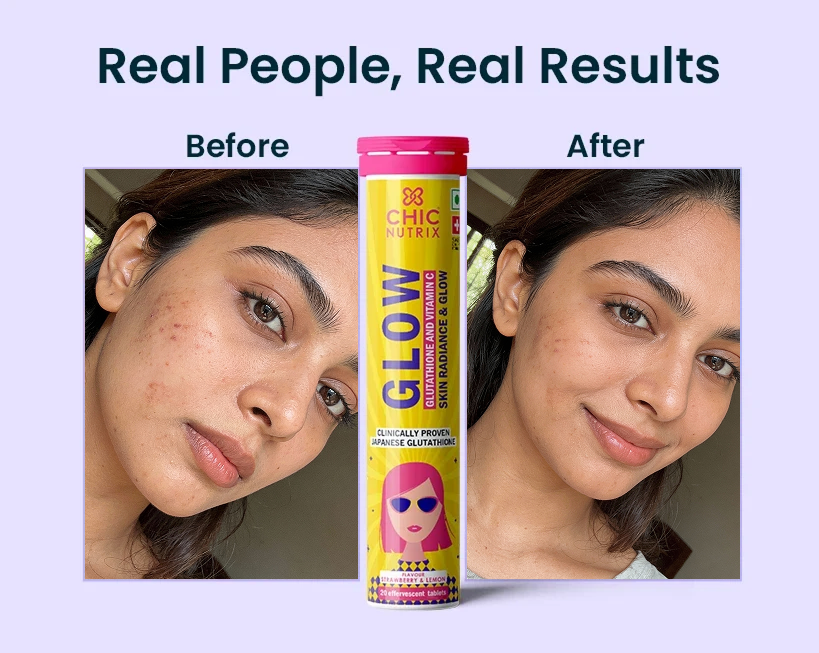 Chicnutrix Glow Glutathione Tablets for Brightening Skin