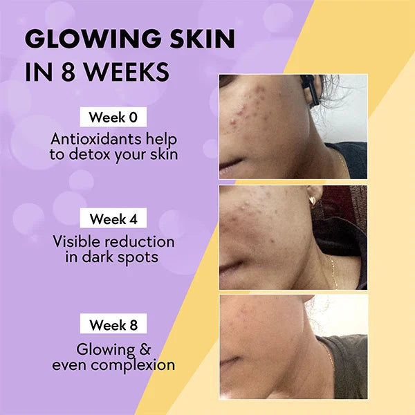 Chicnutrix Glow Glutathione Tablets – 8-Week Skin Glow Challenge with Visible Pigmentation Reduction - Black Currant