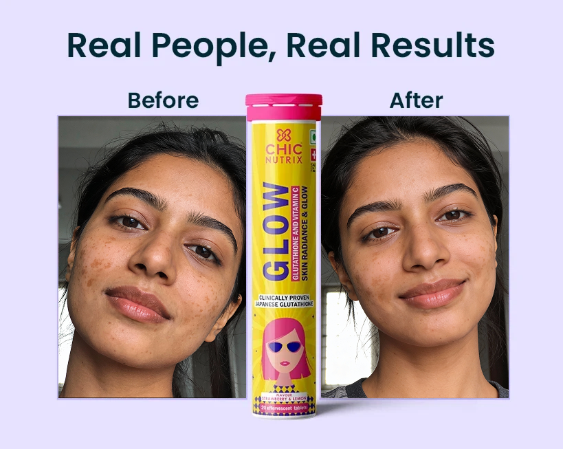 Chicnutrix Glow Glutathione Tablets for Brightening Skin