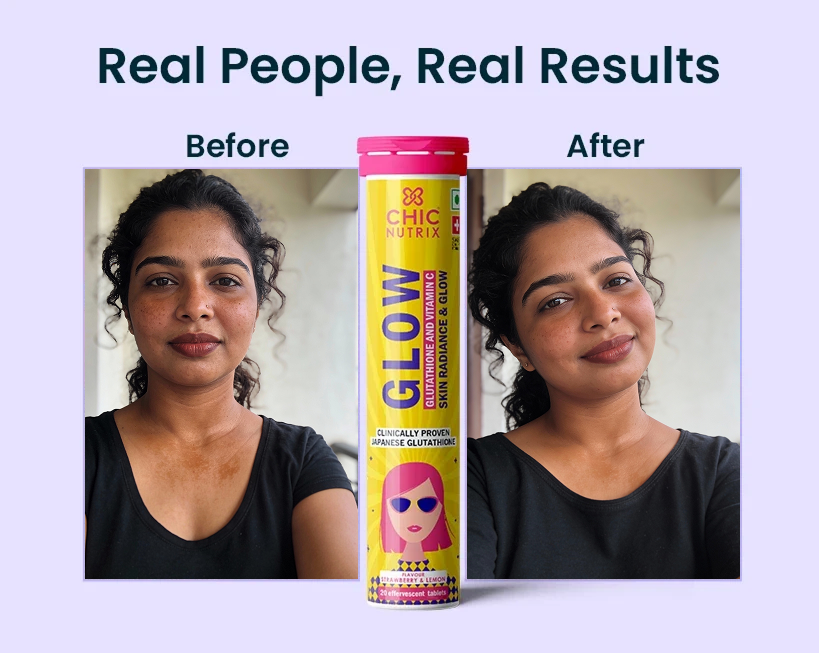 Chicnutrix Glow Glutathione Tablets for Brightening Skin