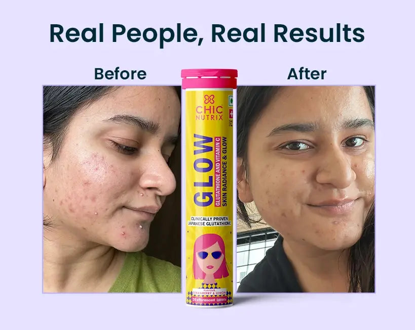 Shop Best Glutathione Tablets for Glowing Skin