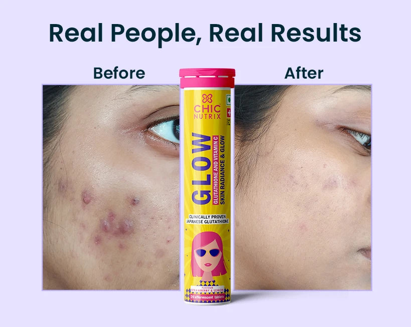 Shop Best Glutathione Tablets for Glowing Skin