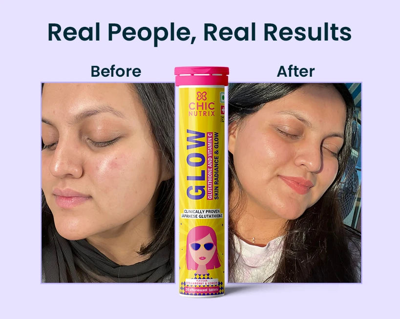 Shop Best Glutathione Tablets for Glowing Skin